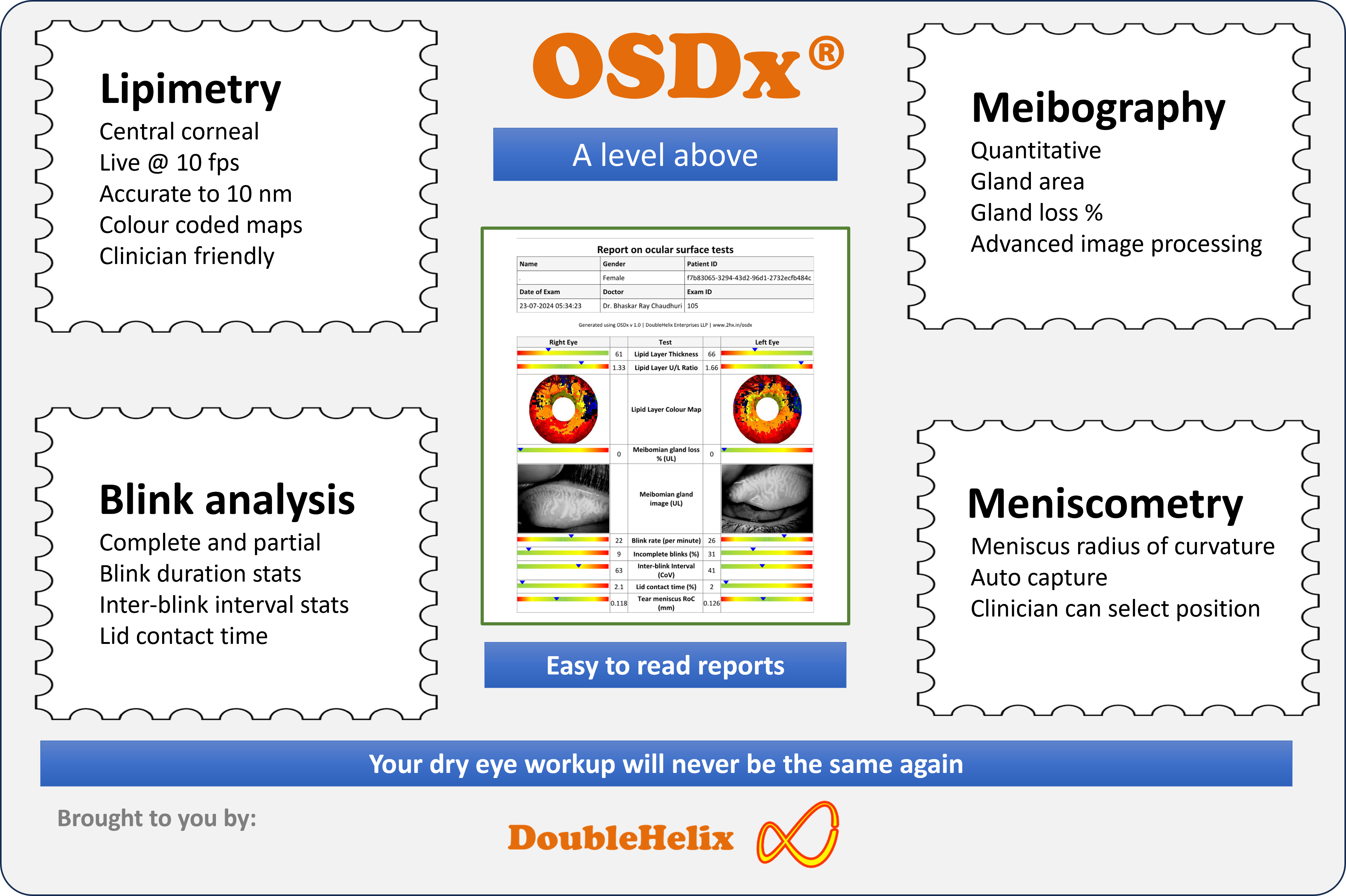 OSDx multi-parametric dry eye diagnostic platform